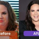 whitney thore weight loss surgery