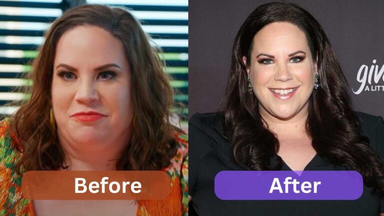 whitney thore weight loss surgery