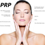 PRP Therapy