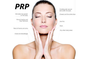 PRP Therapy